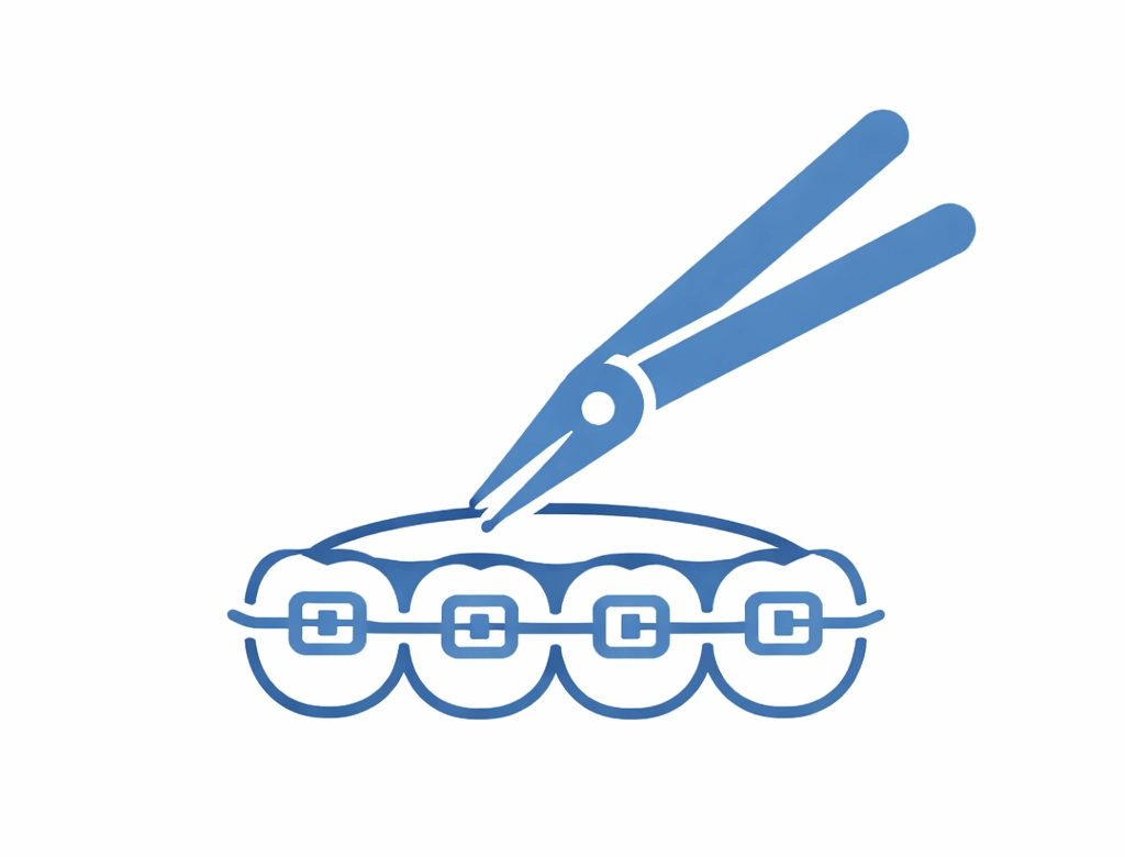 Installing the Archwire