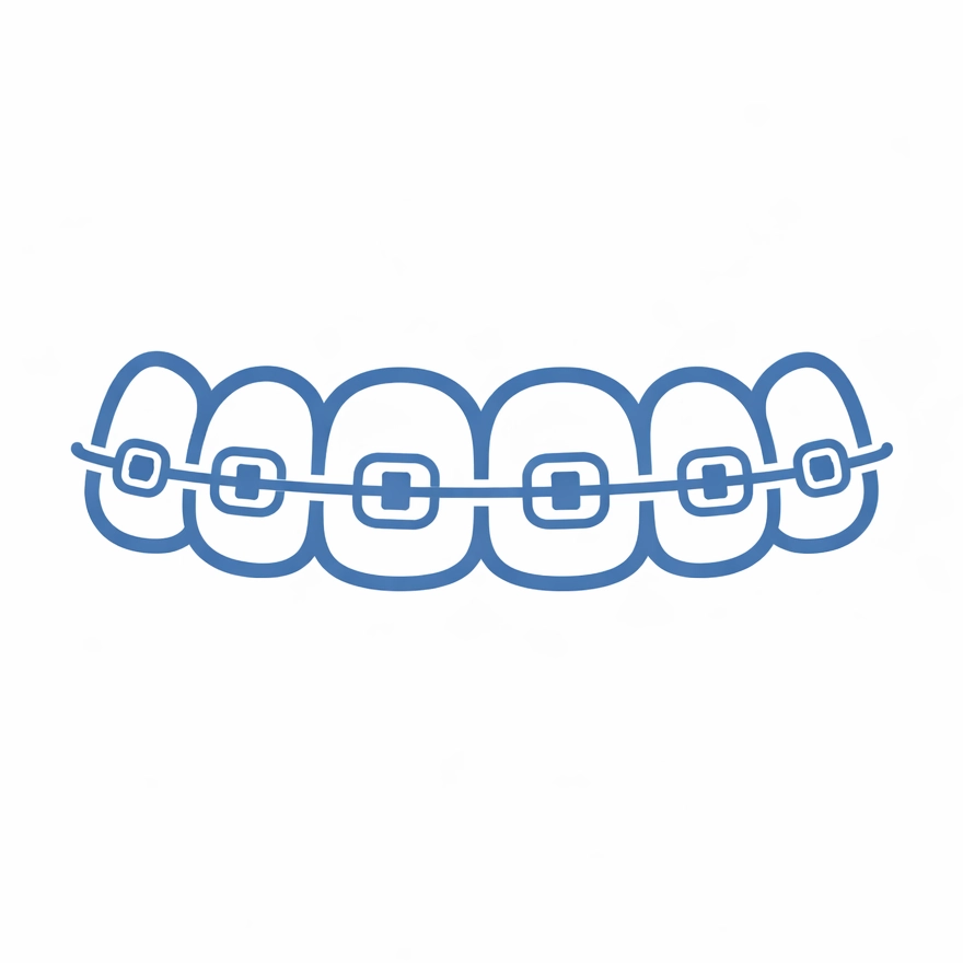 Self-ligating braces