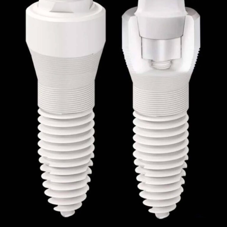 Metal free Zirconia Implants cost in Fort Lauderdale