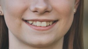Crooked teeth and misaligned bite