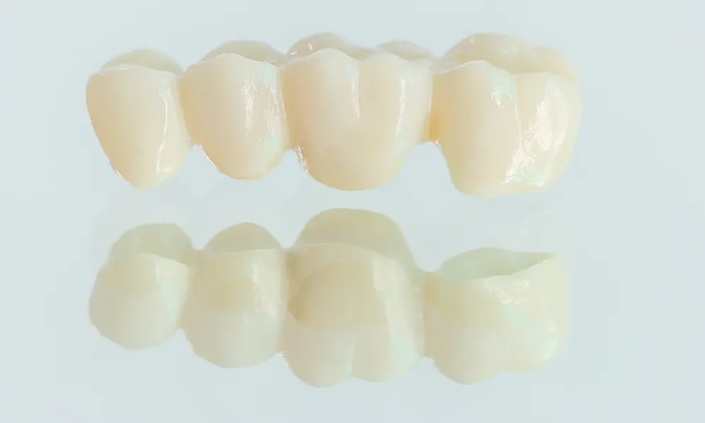 Dental bridge of four crowns