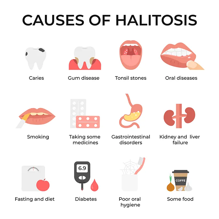 Causes of halitosis, bad breath