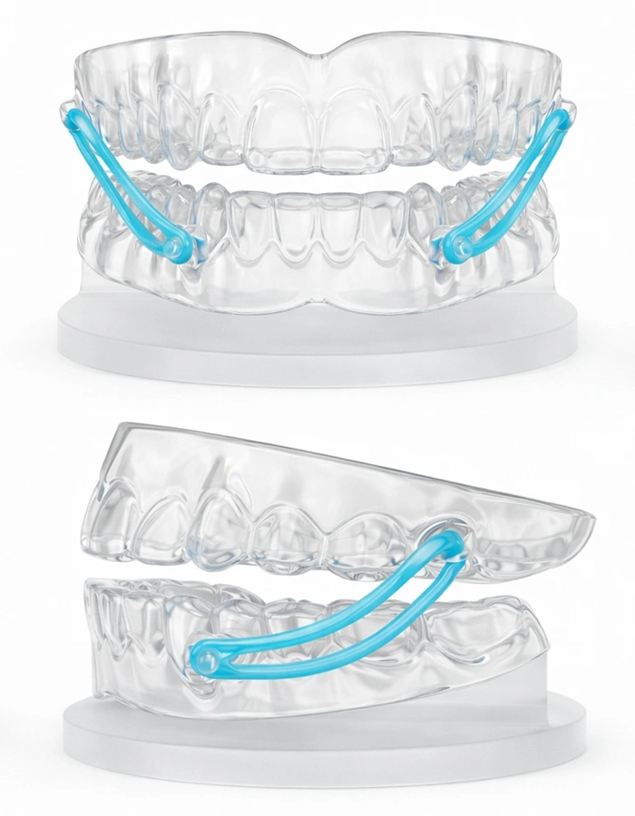 MAD for treating apnea front and side views